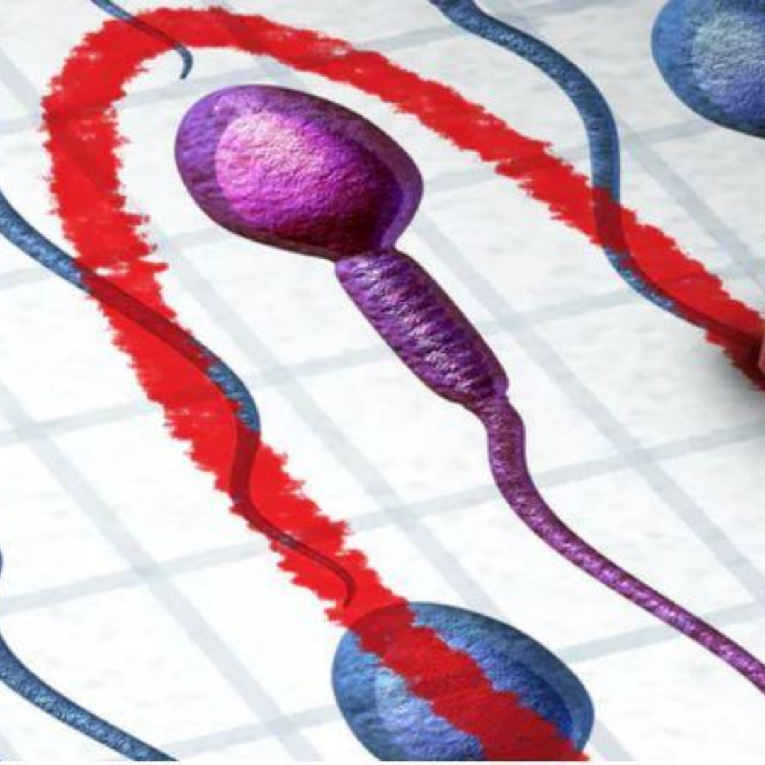 How Men’s Damaged Sperm Could Play Role in Recurrent Miscarriage