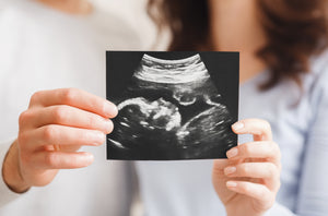 The picture is a couple that is blurred out but they are both holding a sonogram picture of a developing baby.